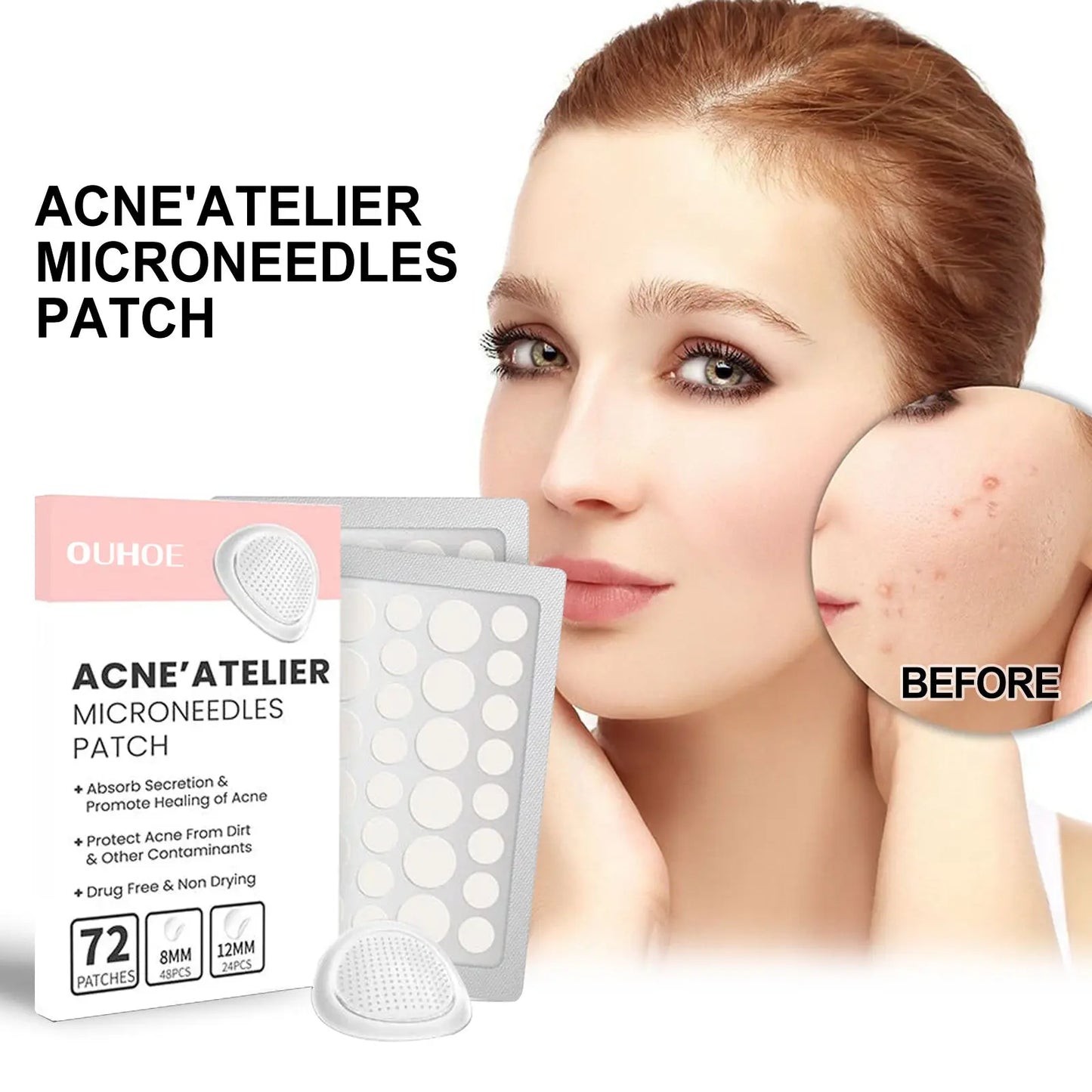   Acne Patch Repair Pore Cleansing & Moisturizing Microneedle Pimple Patch Skincare 